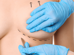 Fuller, Firmer Breasts with Injections
