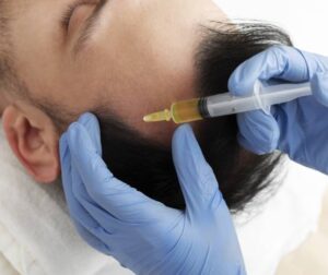 Personalized GFC Treatment for Hair