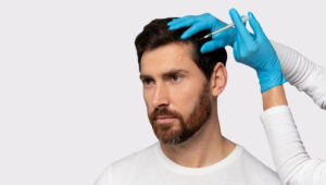 Regrow Hair Naturally with GFC Hair Treatment