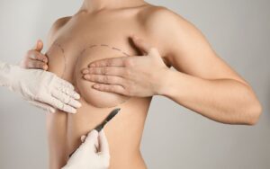 Restore Volume and Shape with Breast Lift Surgery