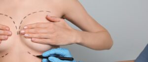 The Benefits of Breast Augmentation