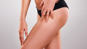 Thigh Lift for Confidence and Elegance