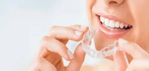 Aligners