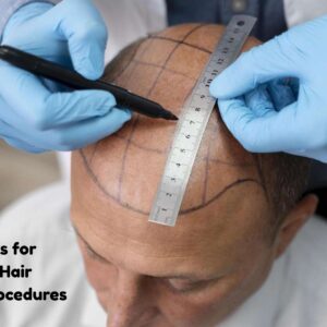 Celebrity hair transplant