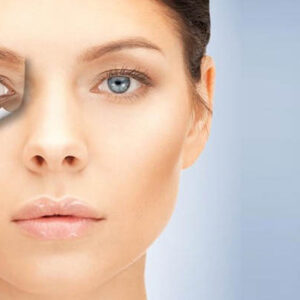 Dark Circles Treatment In Dubai