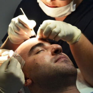 Hair Transplant in Dubai