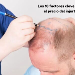 trasplante de pelo precio