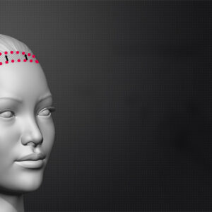 Forehead Reconstruction