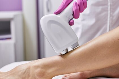 Best Laser Hair Removal in Dubai