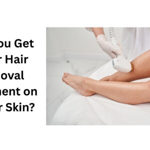 laser hair removal la