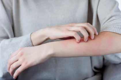 Clear Scabies and Worms Safely with Ivermectin 12 mg