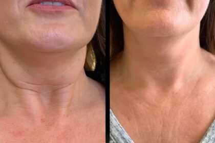 Best Plastic Surgeon in dubai