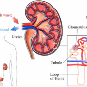 IgAN Diagnosis