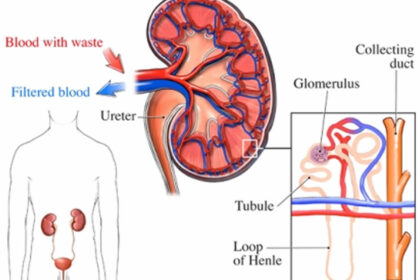 IgAN Diagnosis