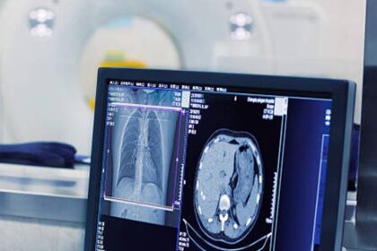 X-ray machine for sale