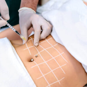 Does Aqualyx Injection Burn Fat