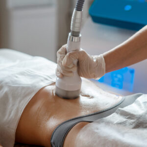 Does Ultrasound Cavitation Tighten Skin?