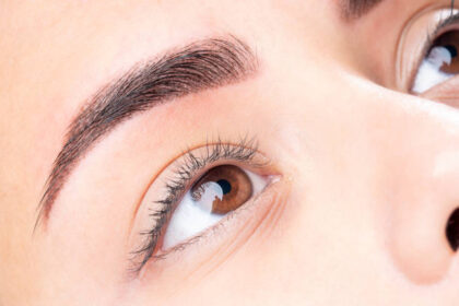 Is Blepharoplasty a Permanent Fix