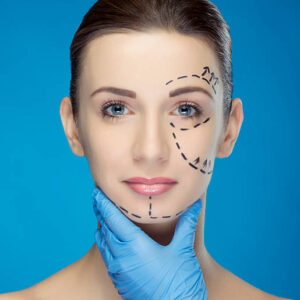 Is Facelift Worth It