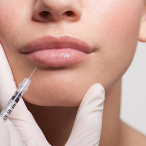 What Age Is Best for Lip Fillers