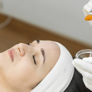 Chemical Peel in Dubai