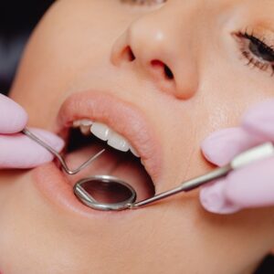 Teeth Cleaning Cost In Dubai
