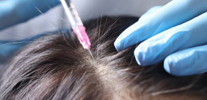 زراعة الشعر في الرياض