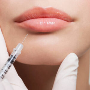 Can Lip Fillers Help Fix Uneven or Thin Lips
