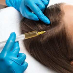 Does Hair PRP Really Work for Baldness
