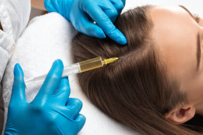Does Hair PRP Really Work for Baldness
