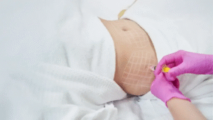 Is Aqualyx Injection a Non-Surgical Fat Solution
