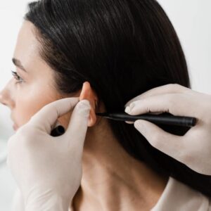 Otoplasty Reshape and Enhance Your Ears