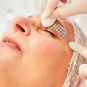 Personalized Eyelid Surgery Plans