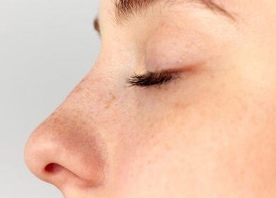 Rhinoplasty in Islamabad