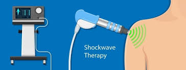 Shockwave Therapy