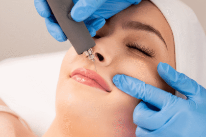Innovative Laser Solutions for Acne Scars