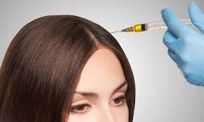 زراعة الشعر في الرياض