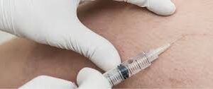 Say Hello to Flawless Legs with Sclerotherapy