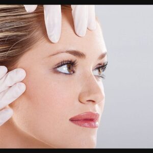 Patient results with the latest Botox techniques showing smoother forehead lines