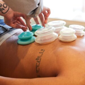 Cupping Therapy in Philadelphia