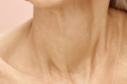 Discover the Benefits of Botox Neck Lift Treatments