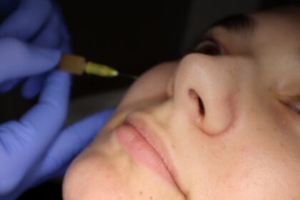 Effective Fat Reduction with Mesotherapy