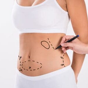 Get the Perfect Contours with Lipomatic