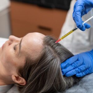 Hair Fillers for Hair Density and Volume