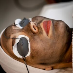 Say Goodbye to Dull Skin with Laser Carbon Peel
