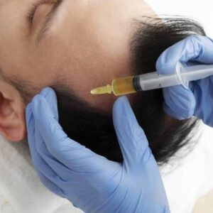 Personalized GFC Treatment for Hair