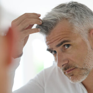 Professional Hair Restoration with FUSS