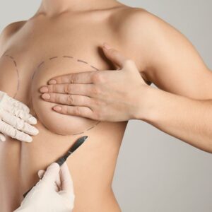 Restore Volume and Shape with Breast Lift Surgery