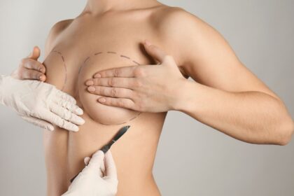 Restore Volume and Shape with Breast Lift Surgery