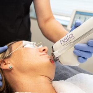Reveal Clear Skin with Halo Laser